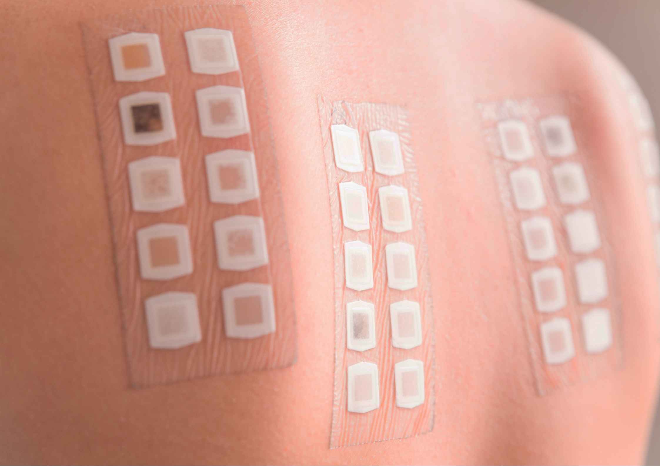 Patch Test Skincare: Cara Aman Coba Produk Baru