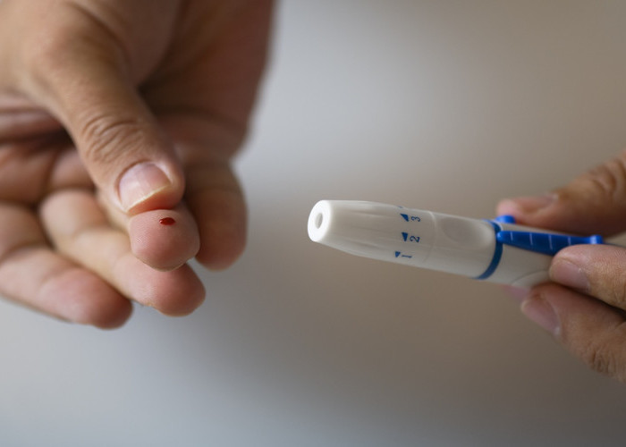 Benarkah Terlalu Banyak Gula Langsung Menyebabkan Diabetes Tipe 2? Ini Penjelasannya