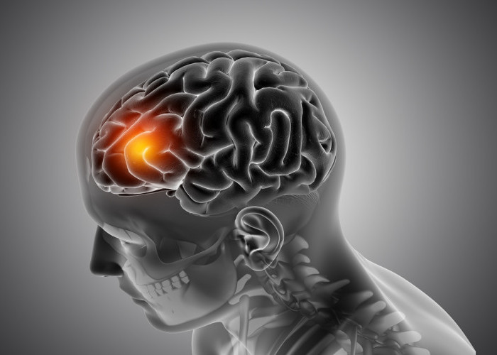 Ilmuwan Ungkap Cara APOE4 Merusak Pembuluh Darah Otak pada Penyakit Alzheimer