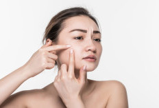 Jerawat Tak Kunjung Hilang? Ini 4 Cara Ampuh Mengatasi Jerawat Membandel Menurut Dokter