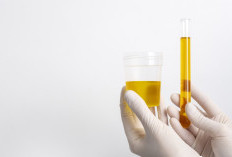 Studi Baru: Tes Urine GALEAS Bladder Deteksi 92,2 Persen Kasus Kanker Kandung Kemih